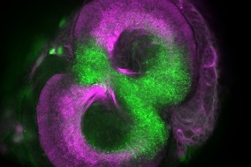 Mushroom body calyx in Eueides isabella showing the segregation of areas that receive information about olfactory (green) and visual (magenta) stimuli. In Heliconius the expansion of the mushroom bodies is particularly linked to increases in visual areas.
